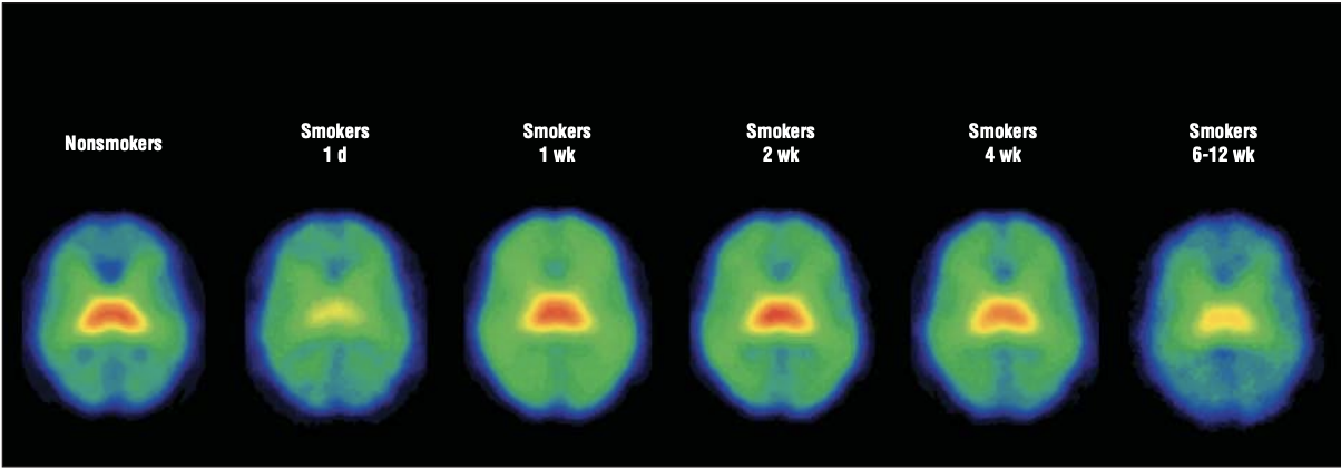 Image of brain regions using SPECT imaging