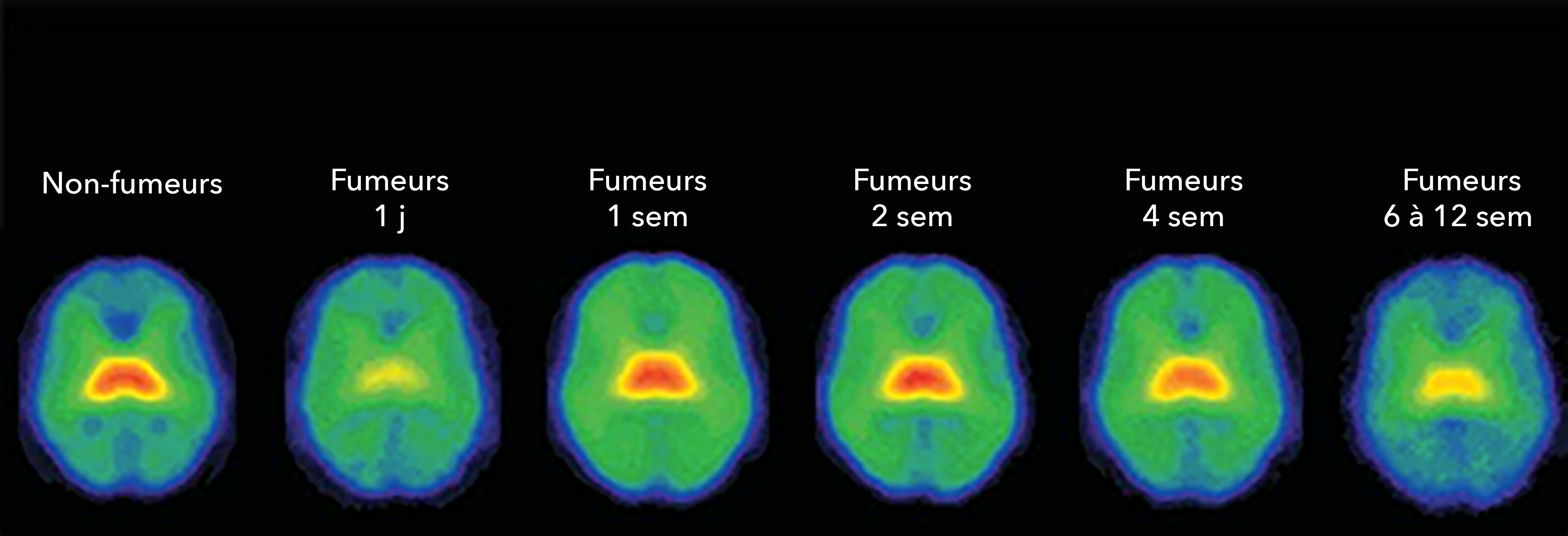 Image of brain regions using SPECT imaging